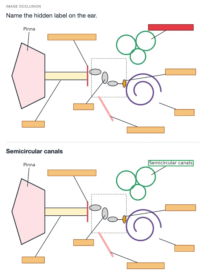 Sample card from Nervous and Endocrine Systems, answer side
